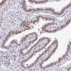 Invitrogen RAD50 Polyclonal Antibody 100 &mu;L | Buy Online | Invitrogen&trade; | Fisher Scientific