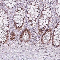 Invitrogen RAD50 Polyclonal Antibody 100 &mu;L | Buy Online | Invitrogen&trade; | Fisher Scientific