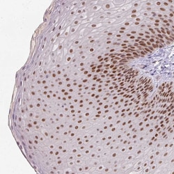 Invitrogen RAD50 Polyclonal Antibody 100 &mu;L | Buy Online | Invitrogen&trade; | Fisher Scientific