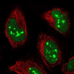 POLR1E Polyclonal Antibody:Antibodies, Polyclonal