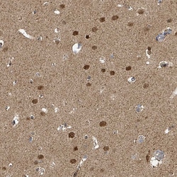 Invitrogen PSMB7 Polyclonal Antibody:Antibodies:Primary Antibodies
