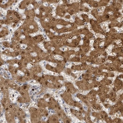 Invitrogen PSMB7 Polyclonal Antibody:Antibodies:Primary Antibodies