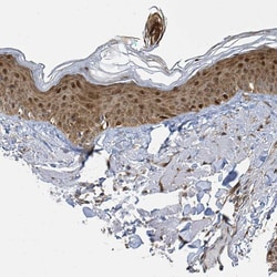 Invitrogen PSMB7 Polyclonal Antibody:Antibodies:Primary Antibodies