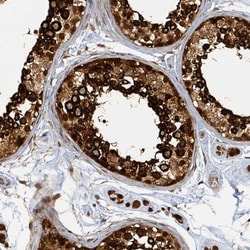 Invitrogen PSMB7 Polyclonal Antibody:Antibodies:Primary Antibodies