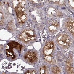 Invitrogen Afamin Polyclonal Antibody 100 &mu;L; Unconjugated:Antibodies,