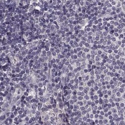 Invitrogen Afamin Polyclonal Antibody 100 &mu;L; Unconjugated:Antibodies,