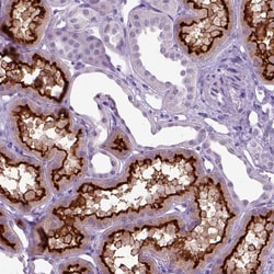 Invitrogen CD10 Polyclonal Antibody 100 μL; Unconjugated:Antibodies,