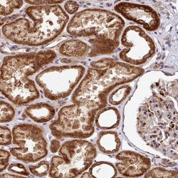 Invitrogen SARS2 Polyclonal Antibody 100 μL; Unconjugated:Antibodies,