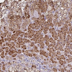 Invitrogen JMJD4 Polyclonal Antibody 100 &mu;L; Unconjugated:Antibodies,