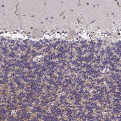 Invitrogen ZIC3 Polyclonal Antibody:Antibodies:Primary Antibodies
