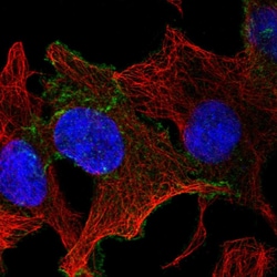 Invitrogen CELSR1 Polyclonal Antibody 100 &mu;L; Unconjugated:Antibodies,