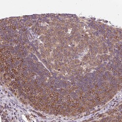 Invitrogen CARD11 Polyclonal Antibody 100 &mu;L; Unconjugated:Antibodies,