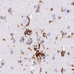 Invitrogen HLA-DRA Polyclonal Antibody 100 &mu;L; Unconjugated:Antibodies,
