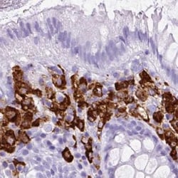Invitrogen HLA-DRA Polyclonal Antibody 100 &mu;L; Unconjugated:Antibodies,