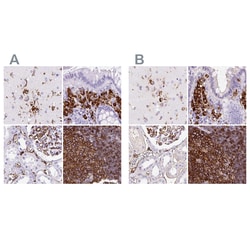 Invitrogen HLA-DRA Polyclonal Antibody:Antibodies:Primary Antibodies