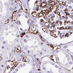 Invitrogen HLA-DRA Polyclonal Antibody 100 &mu;L; Unconjugated:Antibodies,
