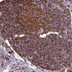 Invitrogen HLA-DRA Polyclonal Antibody 100 &mu;L; Unconjugated:Antibodies,