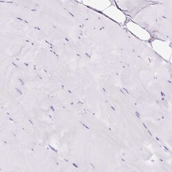 Invitrogen HLA-DRA Polyclonal Antibody 100 &mu;L; Unconjugated:Antibodies,
