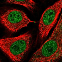 Invitrogen USP3 Polyclonal Antibody 100 &mu;L; Unconjugated:Antibodies,