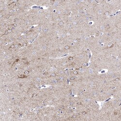 Prodynorphin Polyclonal Antibody:Antibodies, Polyclonal