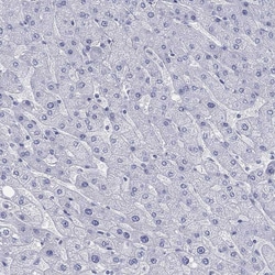 Prodynorphin Polyclonal Antibody:Antibodies, Polyclonal