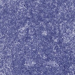 Prodynorphin Polyclonal Antibody:Antibodies, Polyclonal