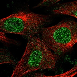 Invitrogen EPM2A Polyclonal Antibody 100 &mu;L; Unconjugated:Antibodies,