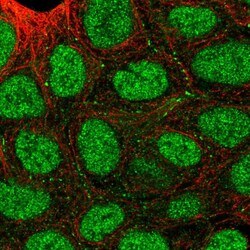 Invitrogen SEMA4A Polyclonal Antibody 100 &mu;L | Buy Online | Invitrogen&trade; | Fisher Scientific