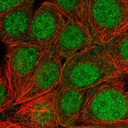 Invitrogen SKP1 Polyclonal Antibody 100 &mu;L; Unconjugated:Antibodies,