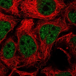 Invitrogen TGIF2 Polyclonal Antibody 100 μL; Unconjugated:Antibodies,