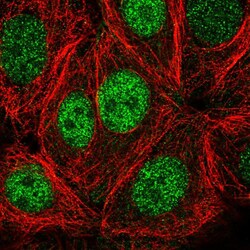 Invitrogen PSKH1 Polyclonal Antibody 100 &mu;L | Buy Online | Invitrogen&trade; | Fisher Scientific