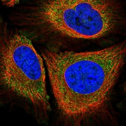Invitrogen PLA2G4A Polyclonal Antibody 100 &mu;L; Unconjugated:Antibodies,