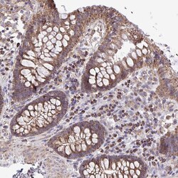 Invitrogen ATP13A2 Polyclonal Antibody:Antibodies:Primary Antibodies