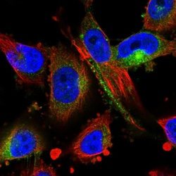 Invitrogen MARCKS Polyclonal Antibody 100 &mu;L; Unconjugated:Antibodies,