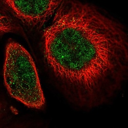 Invitrogen SOX13 Polyclonal Antibody 100 &mu;L; Unconjugated:Antibodies,