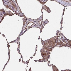 Invitrogen TRAIL Polyclonal Antibody 100 &mu;L | Buy Online | Invitrogen&trade; | Fisher Scientific