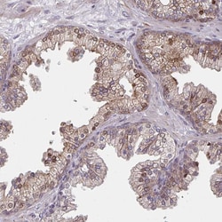 Invitrogen TRAIL Polyclonal Antibody 100 &mu;L | Buy Online | Invitrogen&trade; | Fisher Scientific