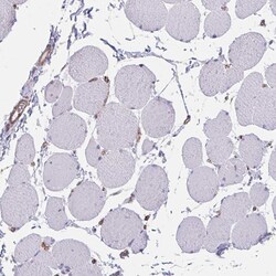 Invitrogen TRAIL Polyclonal Antibody 100 &mu;L | Buy Online | Invitrogen&trade; | Fisher Scientific