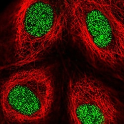 Invitrogen ZFP69 Polyclonal Antibody 100 &mu;L; Unconjugated:Antibodies,