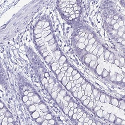 Invitrogen Carbonic Anhydrase IX Polyclonal Antibody 100 &mu;L; Unconjugated:Antibodies,
