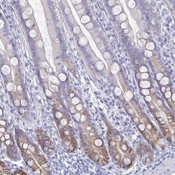Invitrogen Carbonic Anhydrase IX Polyclonal Antibody 100 &mu;L; Unconjugated:Antibodies,