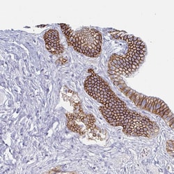 Invitrogen Carbonic Anhydrase IX Polyclonal Antibody 100 &mu;L; Unconjugated:Antibodies,