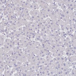 Invitrogen Carbonic Anhydrase IX Polyclonal Antibody 100 &mu;L; Unconjugated:Antibodies,