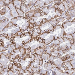 Invitrogen Carbonic Anhydrase IX Polyclonal Antibody 100 &mu;L; Unconjugated:Antibodies,