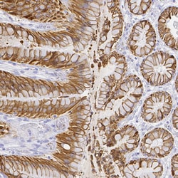 Invitrogen SMURF1 Polyclonal Antibody 100 &mu;L; Unconjugated:Antibodies,