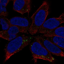 Invitrogen DCC Polyclonal Antibody 100 &mu;L; Unconjugated:Antibodies,