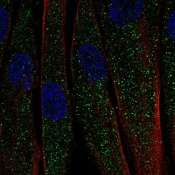 Invitrogen CTRP7 Polyclonal Antibody 100 &mu;L; Unconjugated:Antibodies,