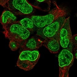 Invitrogen Carboxypeptidase D Polyclonal Antibody 100 μL; Unconjugated:Antibodies,