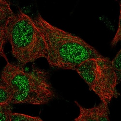 Invitrogen EPM2A Polyclonal Antibody 100 &mu;L; Unconjugated:Antibodies,