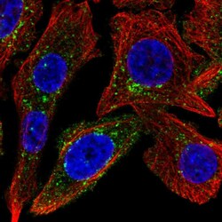 Invitrogen SPRY4 Polyclonal Antibody 100 &mu;L; Unconjugated:Antibodies,